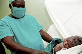 5 facts about caesarean section you probably didn’t know