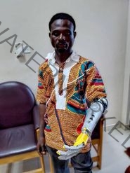 Discover How This Ingenious Individual Created Africa’s First AI Prosthetic Arm