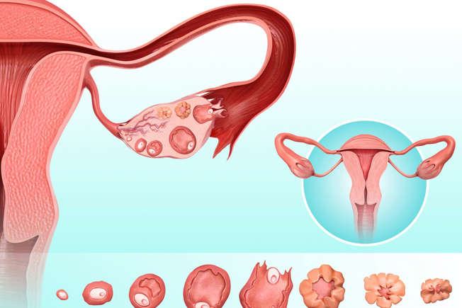 Why women should keep menstruating for as long as they live